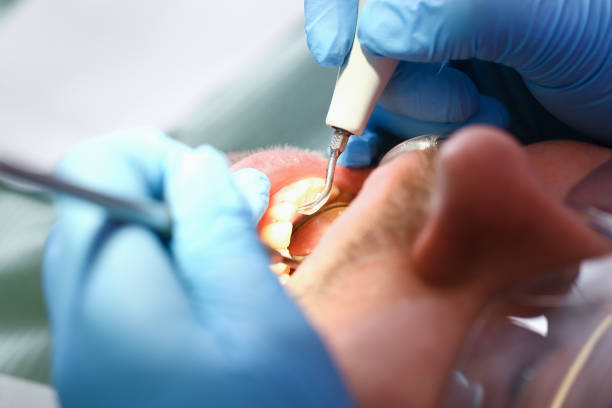 Best Mobile Emergency Dentist in Badieville, LA
