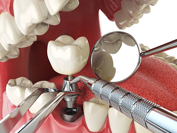 Best Emergency Dentist for Special Needs Patients in Badieville, LA