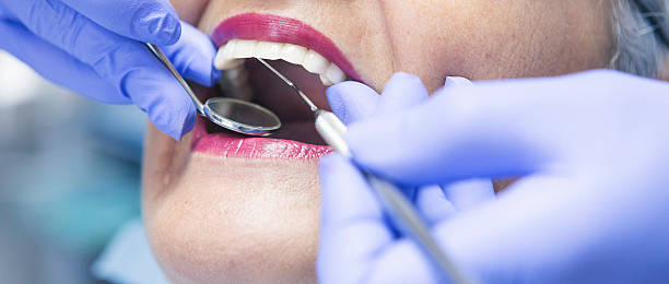 Best Emergency Dental Extractions in Badieville, LA